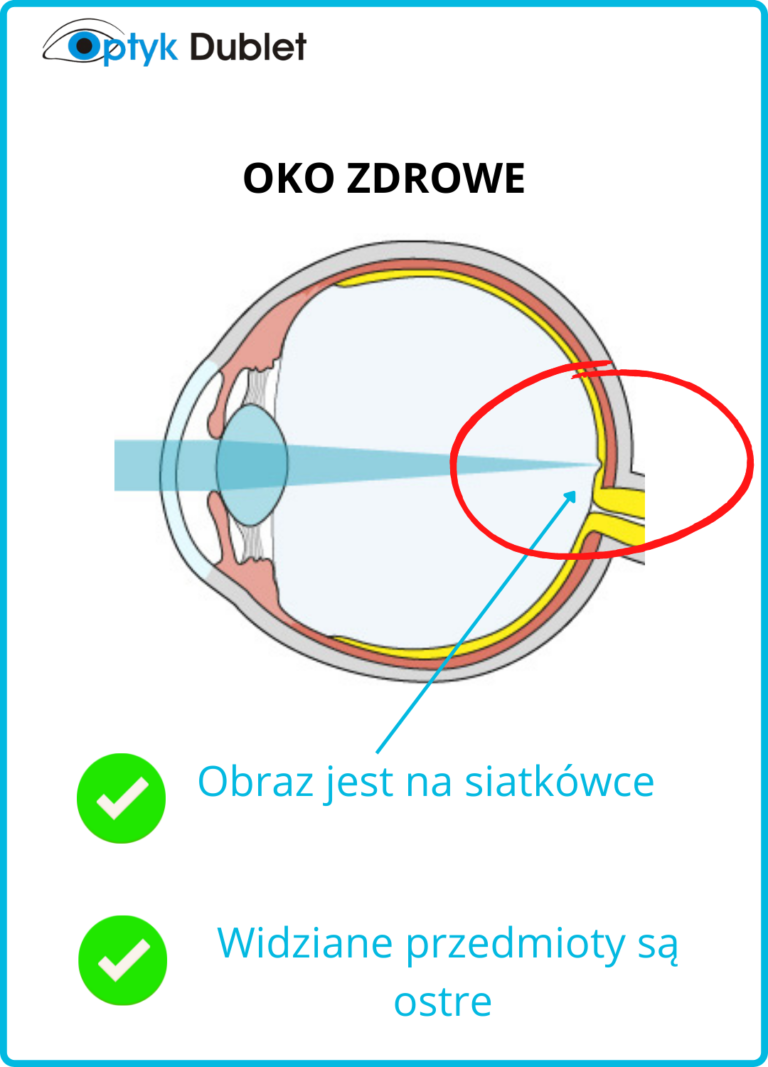 Soczewki do hamowania krótkowzroczności Miyosmart Optyk Dublet.pl Oława Oleśnica (5)